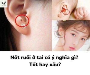 Nốt ruồi ở tai có ý nghĩa gì? Tốt hay xấu?